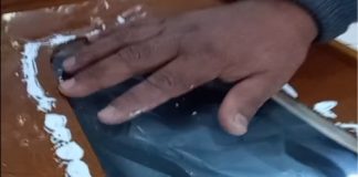 FAMÍLIA QUE RECEBEU ENTE QUERIDA PARA VELÓRIO DENTRO DE UM SACO DE LONA,DENTRO DO CAIXÃO, NÃO OBTEVE AMPARO E ENTERROU SUA PARENTE DO MESMO JEITO