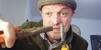 Agulha de injeção na UPA em Palmas quebra em corpo de criança, que necessita de cirurgia