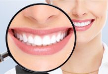Lente de Contato Dental em Resina: a nova tendência em estética odontológica