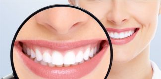 Lente de Contato Dental em Resina: a nova tendência em estética odontológica