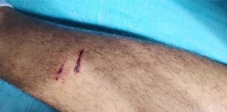 Cachorros de rua atacam novamente no perímetro central de Palmas