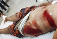 PCPR ELUCIDA ATROPELAMENTO DE CRIANÇAS, OCORRIDO NA NOITE DE DOMINGO