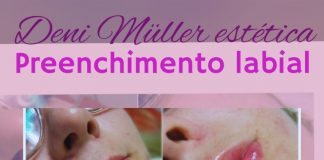 Preenchimento labial